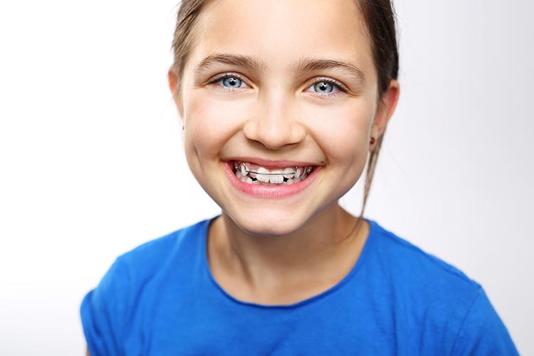 Myths & Facts about orthodontic treatments | Happy Kids Dental